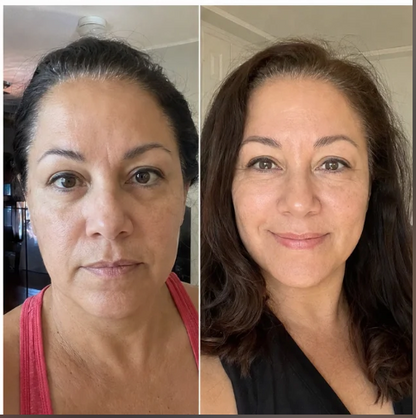 Customer before and after wearing the clear face-lifting strips.