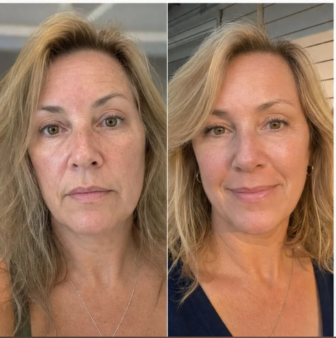 Additional customer before and after result.