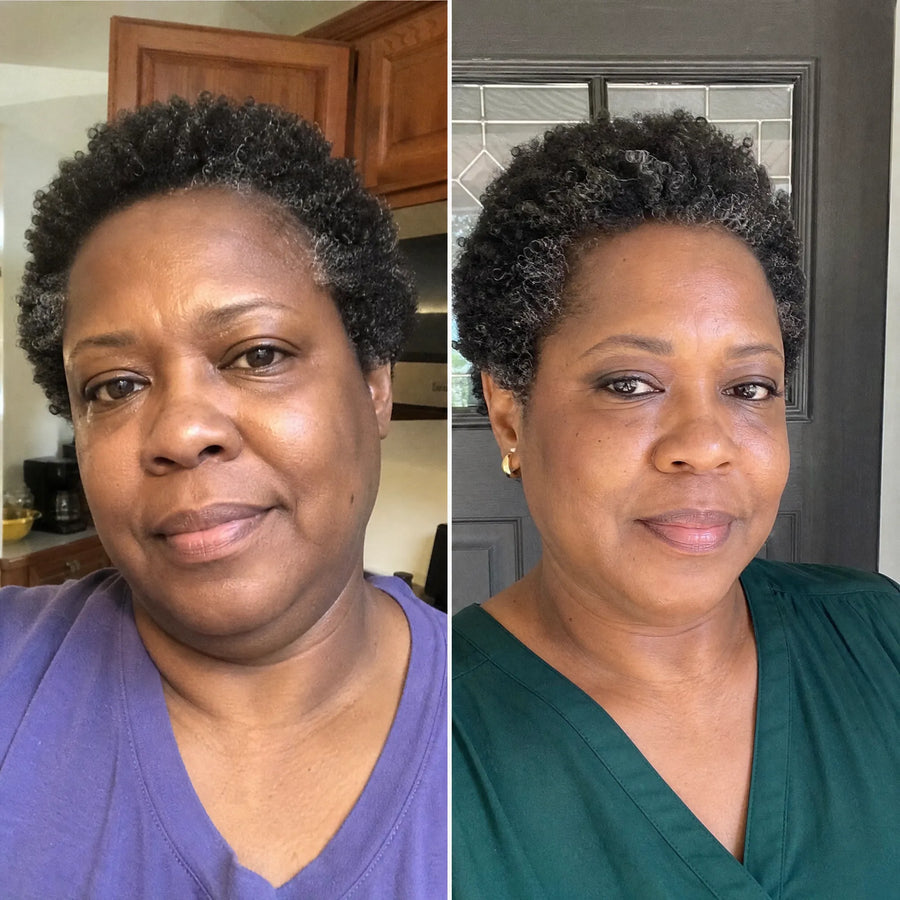 Customer 2 of 15, before on the left and wearing the clear face-lifting strips on the right.