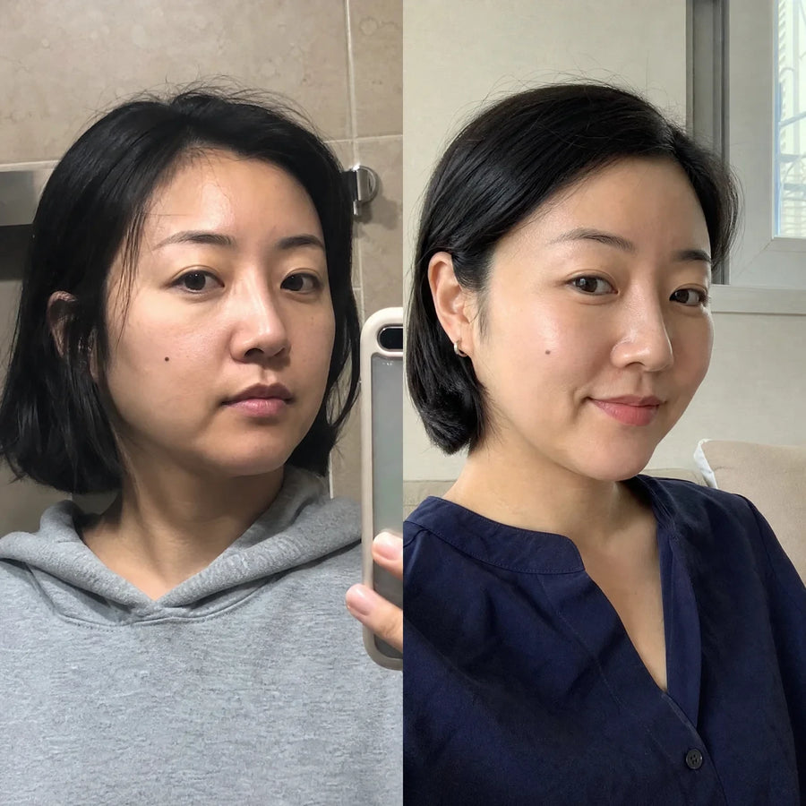 Customer 3 of 15, before on the left and wearing the clear face-lifting strips on the right.