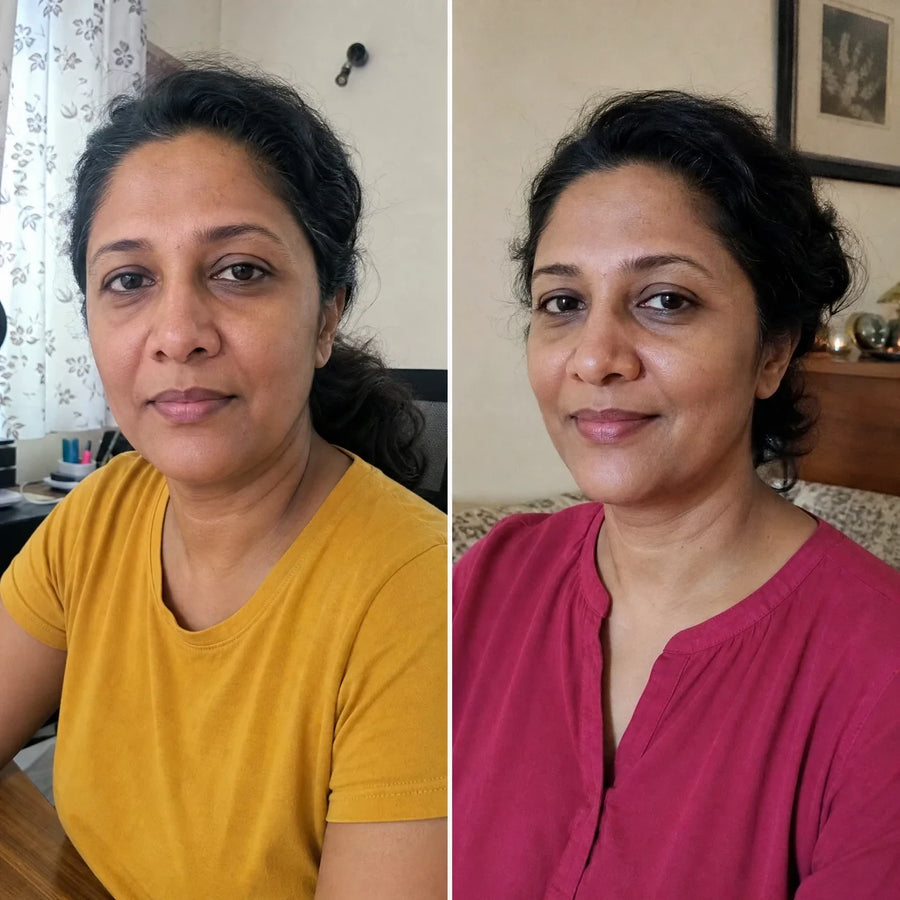 Customer 6 of 15, before on the left and wearing the clear face-lifting strips on the right.