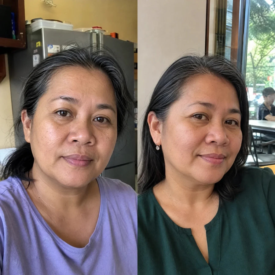Customer 10 of 15, before on the left and wearing the clear face-lifting strips on the right.