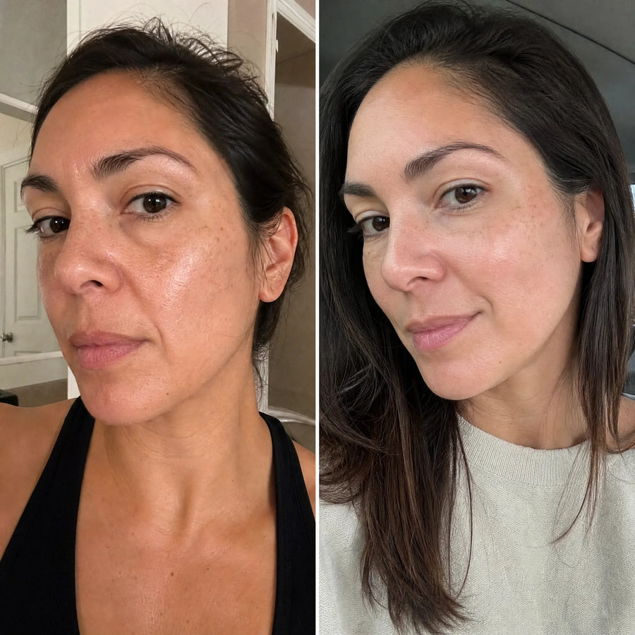 Customer 12 of 15, before on the left and wearing the clear face-lifting strips on the right.