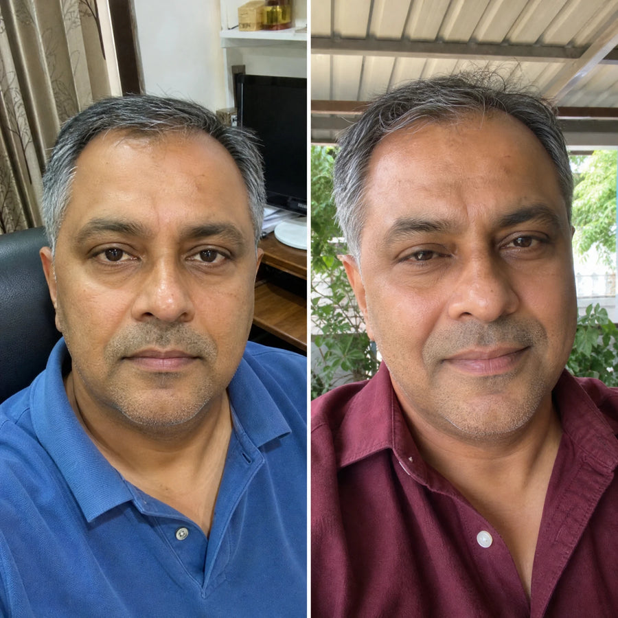 Customer 13 of 15, before on the left and wearing the clear face-lifting strips on the right.